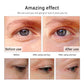קרם עיניים קוריאני לחידוש העור- K.eyeCream